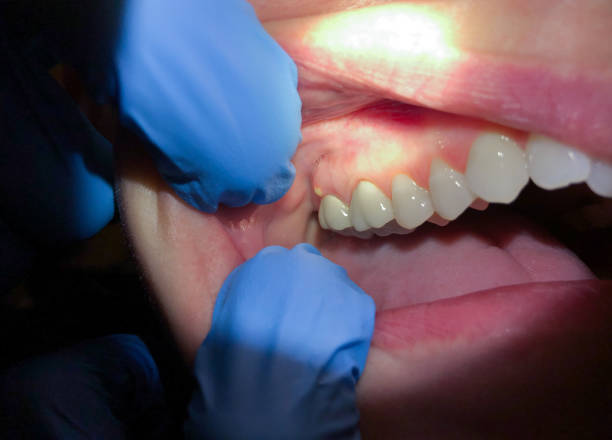 Best Emergency Cosmetic Dentistry in Round Lake, IL